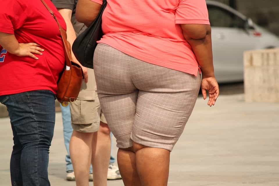 obese woman 