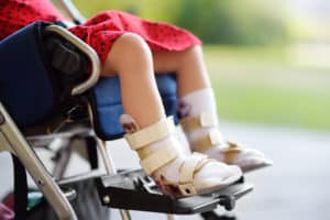 child in wheelchair with feet braces